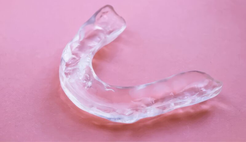 Bite occlusale termoformato – Soluzione personalizzata per limitare il bruxismo e alleviare le tensioni muscolari