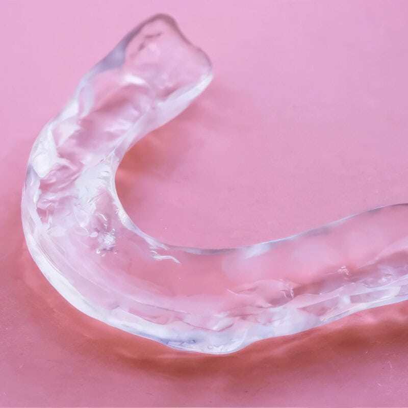 Bite occlusale termoformato – Soluzione personalizzata per limitare il bruxismo e alleviare le tensioni muscolari