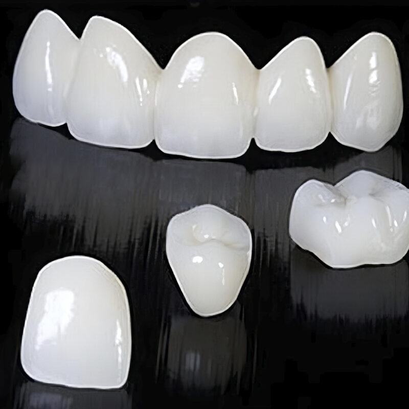 Corona Full Zirconia Multistrato – Protesi dentale 100% zirconia, traslucida e resistente, per un restauro durevole ed estetico 2