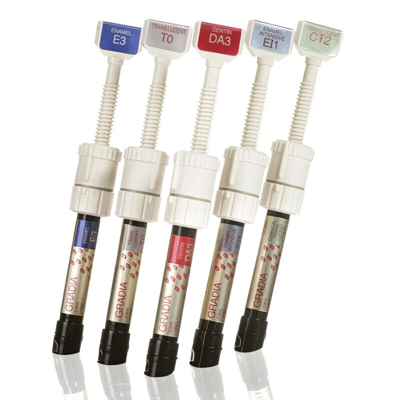 Inlay Onlay composite – Soluzione estetica e duratura per ripristinare la dentatura, alternativa moderna alle otturazioni tradizionali 1