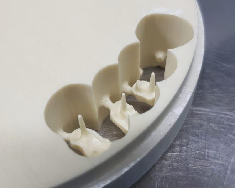 Inlay-core in fibra di vetro – Soluzione innovativa per una restaurazione dentale resistente, estetica e biocompatibile 3